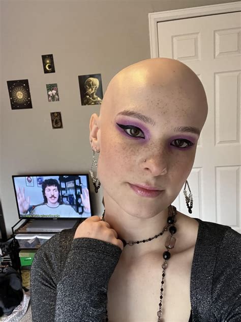 reddit bald|More.